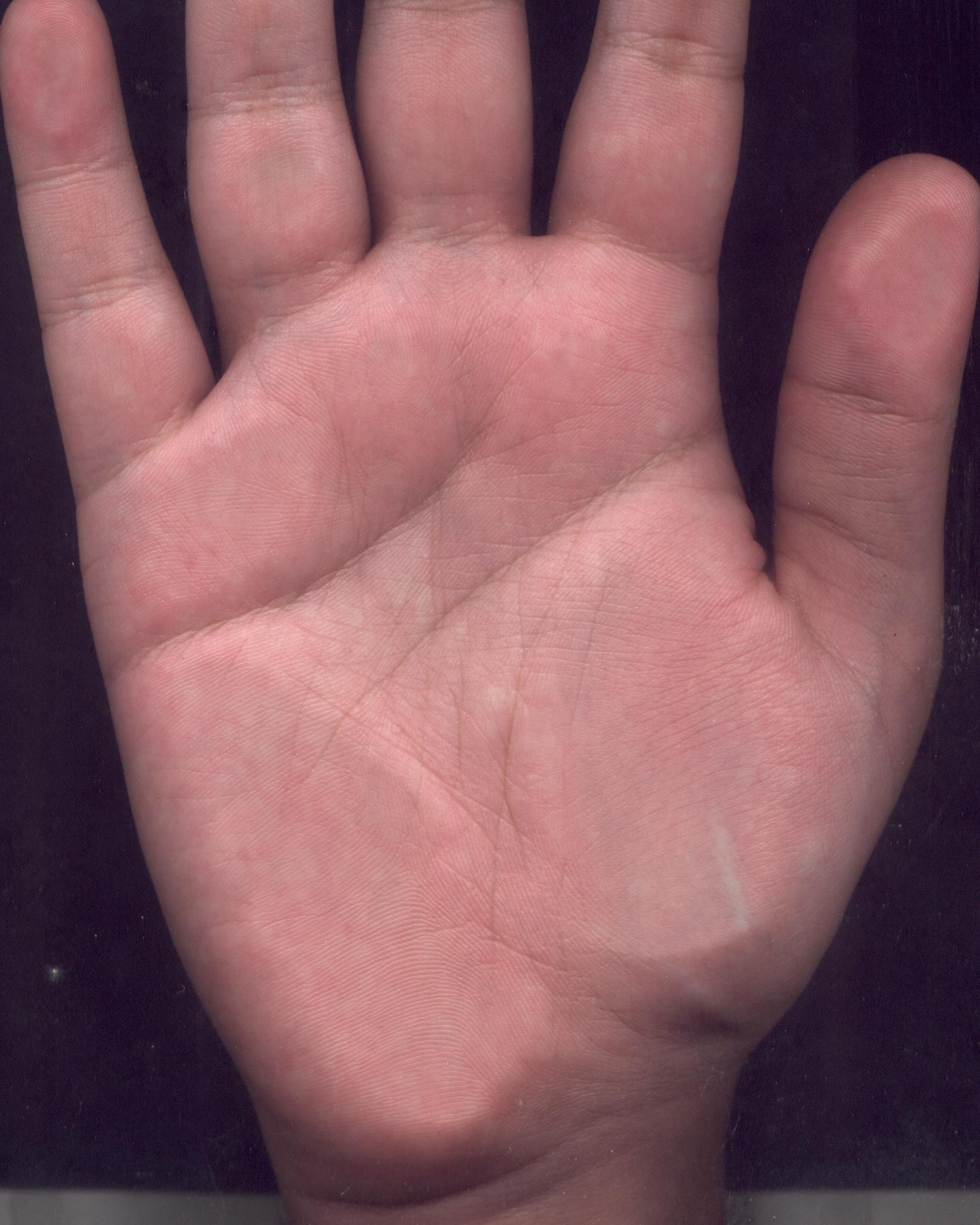 Right Palm new one.JPG